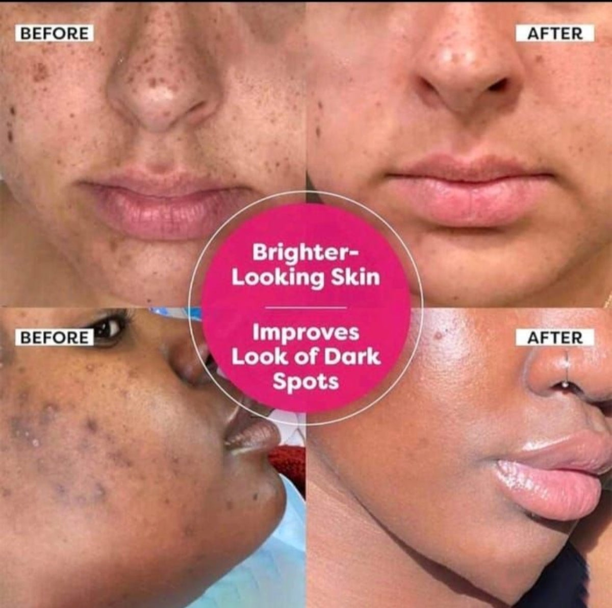 Seemsure Dark Spot Corrector-Brightening Serum
